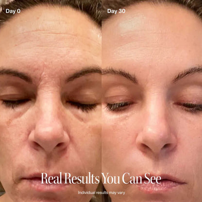 Scheerz 4-in-1 Skincare Wand